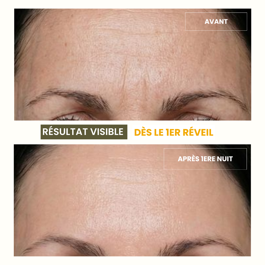 Patch Frontal Anti-ride