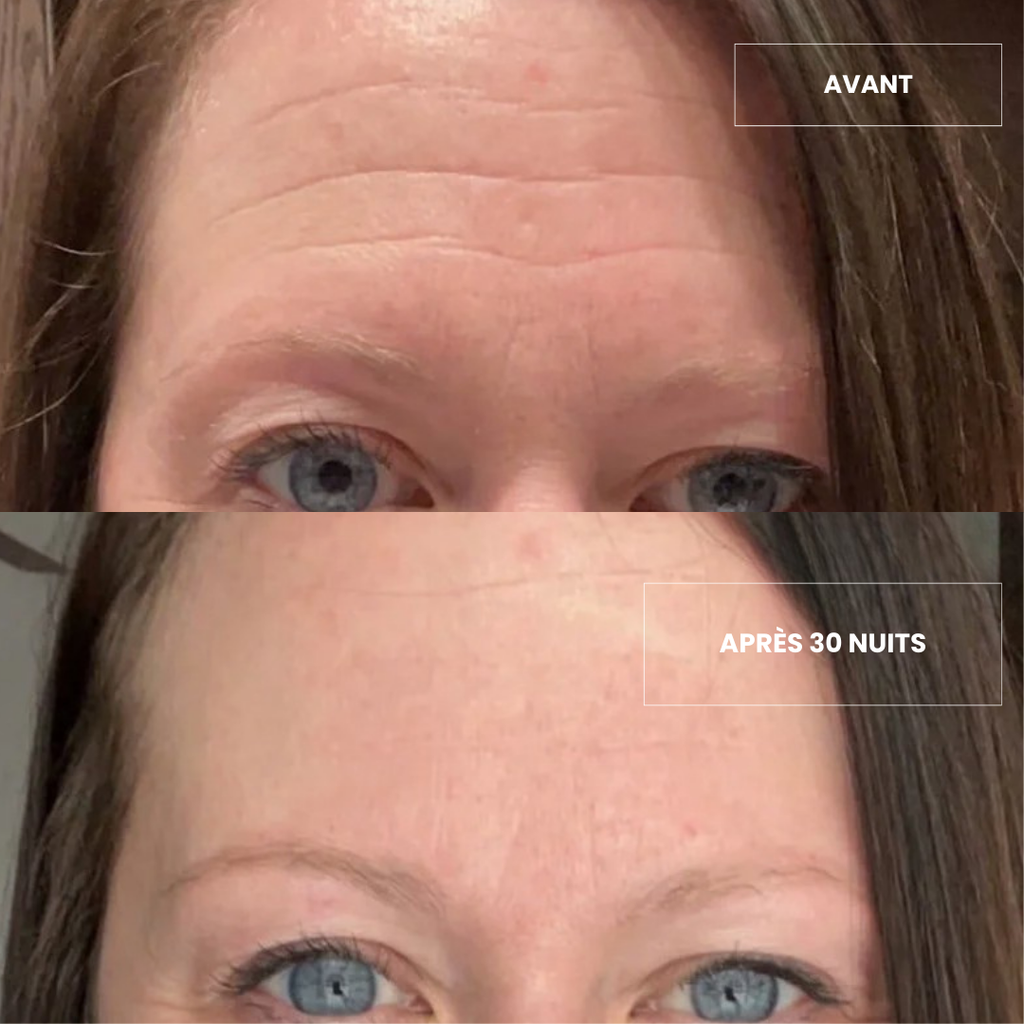 Patch Frontal Anti-ride