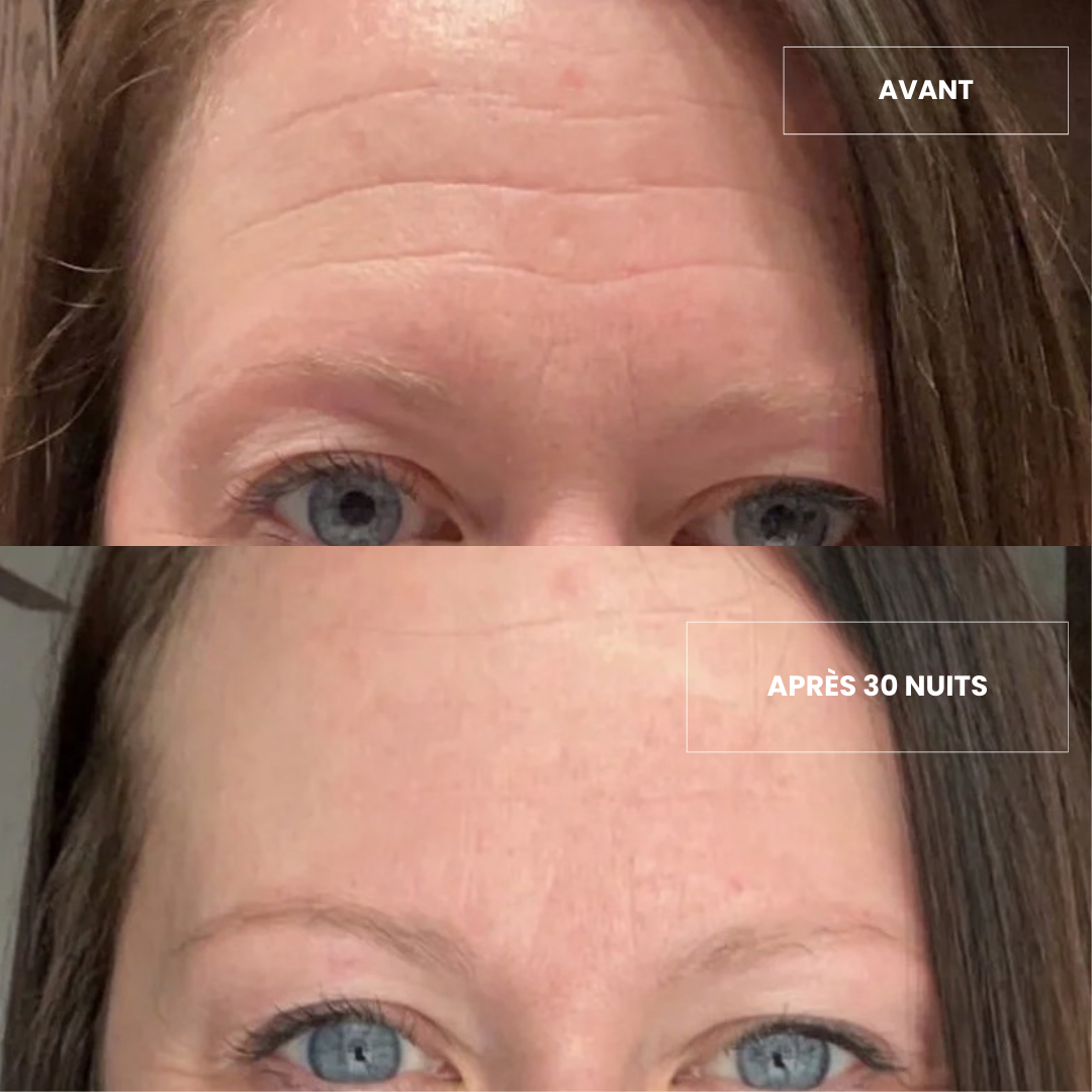 Patch Frontal Anti-ride